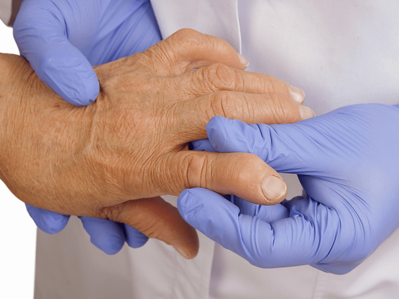 gydytojas apžiūri ranką, ar neskauda pirštų sąnarių